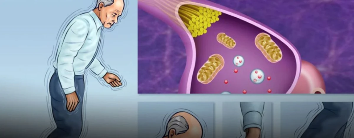 Parkinson Belirtilerine Dikkat: Erken Teşhis Hayat Kalitesini Artırıyor